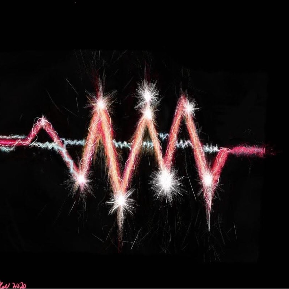 “An electric start to a heart beating in love”